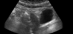 Chirurgia delle masse addominali, ginecologica e oncologica