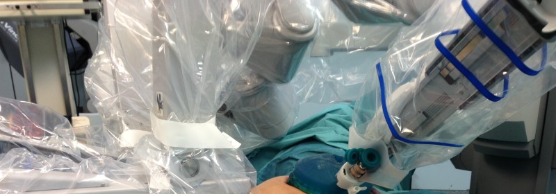 Nuovo approccio ibrido laparoscopico Hand Assisted e robotico con il sistema Da Vinci nelle proctocolectomie totali