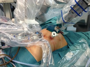 Nuovo approccio ibrido laparoscopico Hand Assisted e robotico con il sistema Da Vinci nelle proctocolectomie totali